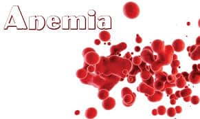 anemia