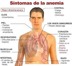 sintomas anemia