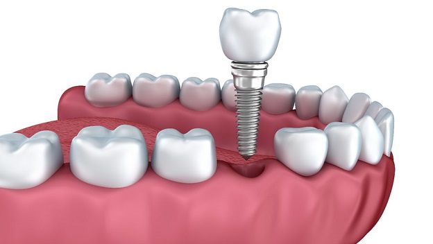 calidad y altos servicios sobre dentistas en lleida