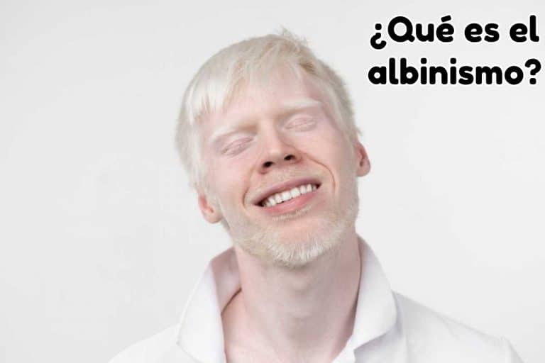 ¿Qué es el albinismo?