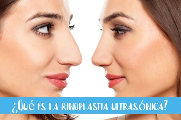 ¿Qué es la rinoplastia ultrasónica?