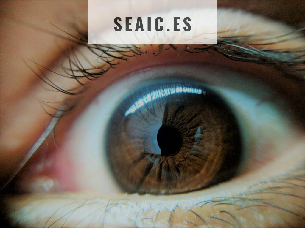 Operación Cataratas Madrid: guía clara y completa para entender el proceso, recuperar visión y vivir el antes y el después